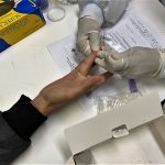 SUS passa a oferecer teste rápido de dengue