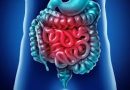 Em 13 anos, doença inflamatória intestinal cresce 5 vezes no Brasil